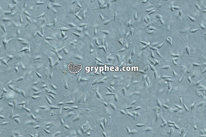 Oursin - Spermatozoïdes d'Oursin x100  - gryphea.com